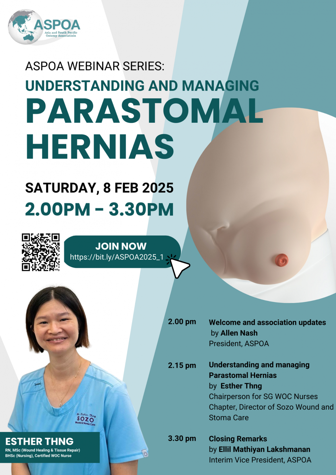 ASPOA Webinar Series: Understanding and Managing Parastomal Hernias